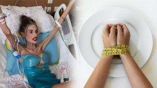 Aç kalma hastalığı değil, ölümcül bir psikolojik rahatsızlık! Anoreksiya nevroza nedir? Anoreksiya nasıl tedavi edilir?