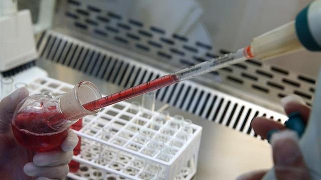 Bilim dünyasında bir ilk: Yeni kan grubu keşfedildi! Ne kan alabiliyor ne verebiliyor...