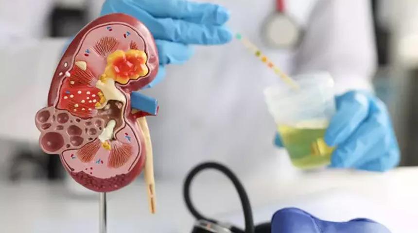Böbrek üstü bezi tümörleri hayati hormonlarınızı etkiliyor! Organ koruyucu cerrahi yöntem: Parsiyel adrenalektomi nedir?