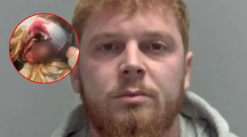 Kan donduran olay! Kız arkadaşının kaşını koparttı! Genç kadına yapmadığını bırakmamış! Yatak odasına sürükleyip...