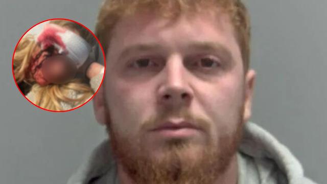 Kan donduran olay! Kız arkadaşının kaşını koparttı! Genç kadına yapmadığını bırakmamış! Yatak odasına sürükleyip...