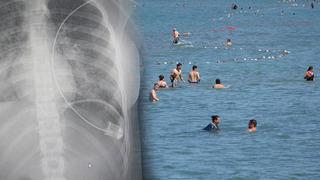 Tatil mevsimi başladı! Boğulma tehlikesi kapıda: Son 4 yılda 4 bine yakın vatandaşımızı kaybettik 