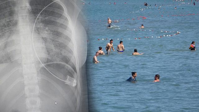 Tatil mevsimi başladı! Boğulma tehlikesi kapıda: Son 4 yılda 4 bine yakın vatandaşımızı kaybettik 