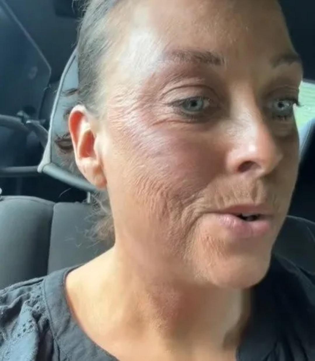 Güzelleşmek isterken hayatının hatasını yaptı! Kullandığı ürünü çoğu kadın yüzüne sürüyor: "80 yaşında görünüyorum" 2