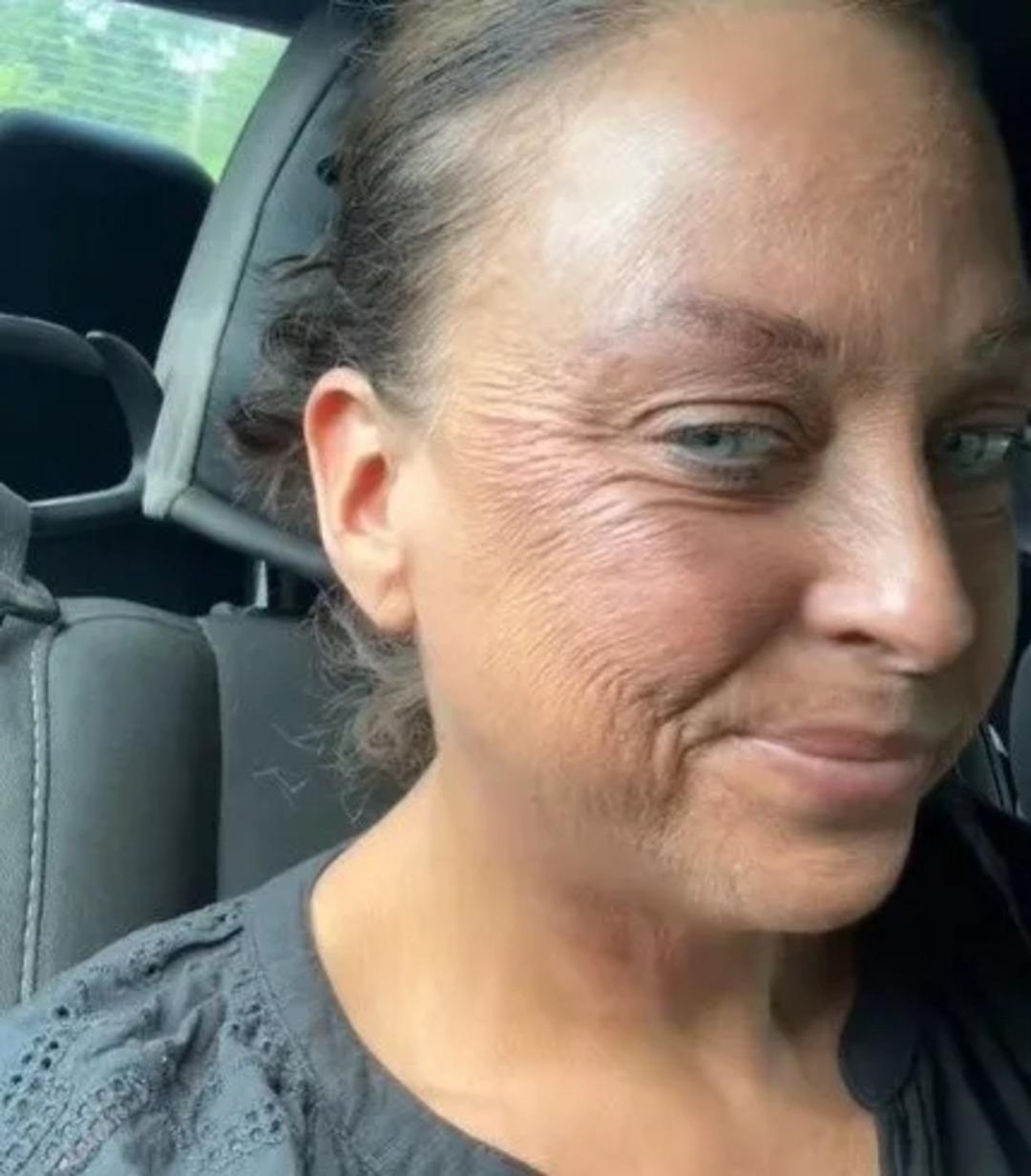 Güzelleşmek isterken hayatının hatasını yaptı! Kullandığı ürünü çoğu kadın yüzüne sürüyor: "80 yaşında görünüyorum" 3