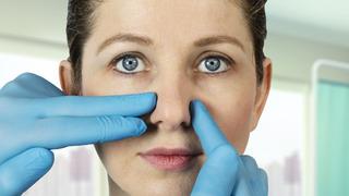 Rinoplasti nedir? Rinoplasti ne demek?