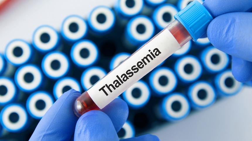 Talasemi nedir? Talasemi belirtileri ve tedavisi