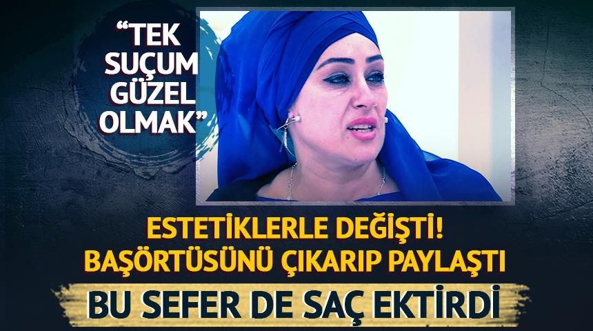 Bu sefer saç ektirdi! Başörtüsünü çıkarıp paylaştı