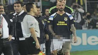 Meireles buz torbasını tutmuş..