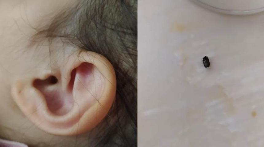 İzmit’te parkta 3 yaşındaki çocuğun kulağına kene yapıştı