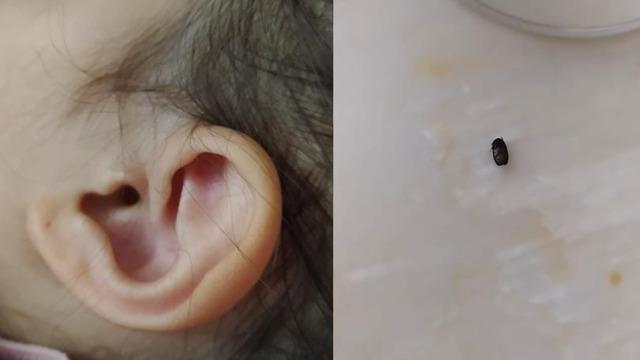 İzmit’te parkta 3 yaşındaki çocuğun kulağına kene yapıştı