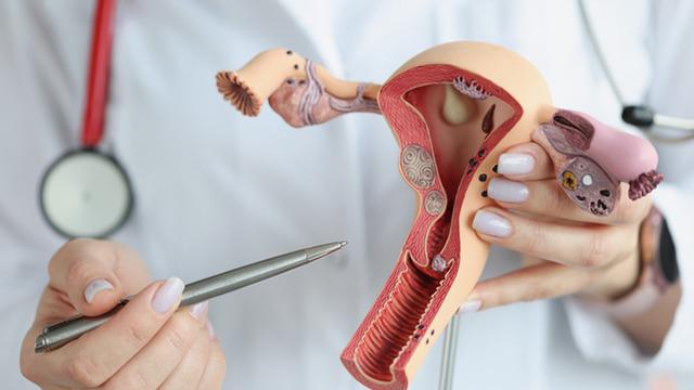 Kadınlar bu yöntemi yeterince bilmiyor! Adet düzensizliği ve rahim hastalıklarına çözüm: Histeroskopi nedir? 