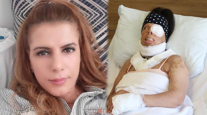 Eski sevgiliden uykuda kezzap vahşeti: Kıkırdakları eridi, gözü aktı! Her satırı korkunç