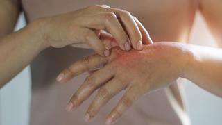 Yaz enfeksiyonlarına dikkat! Uzmanlar uyarıyor: En büyük bulaş kaynağı ellerimiz