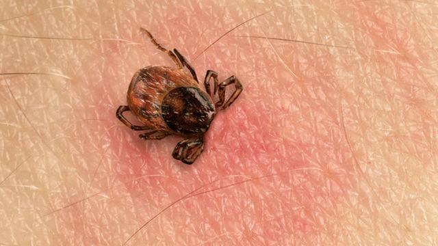 Kene ısırığı vakalarında ciddi artış! 15 gün boyunca kan emerek yaşarlar: Çok hızlı çoğalabilen hayvanlardır 