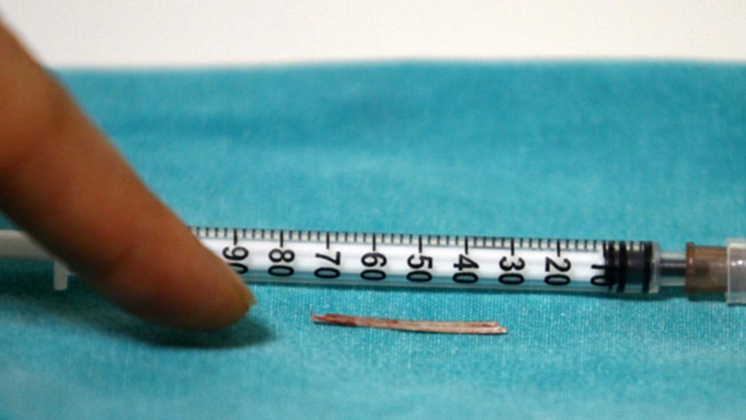 Yok artık dedirten olay! Boyun ağrısı çekiyordu sebebi şaşkınlık yarattı... 1