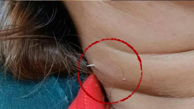 Yok artık dedirten olay! Boyun ağrısı çekiyordu bakın ne çıktı