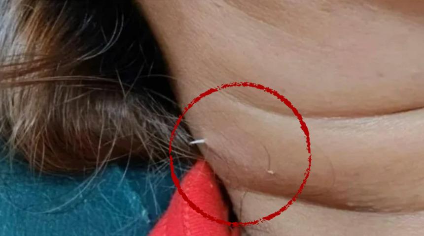 Yok artık dedirten olay! Boyun ağrısı çekiyordu sebebi şaşkınlık yarattı...