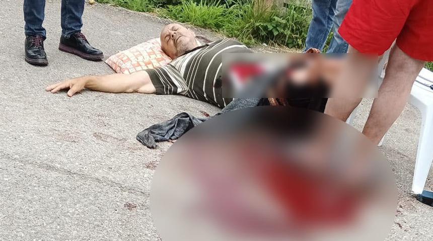 Yer: Trabzon! Tartıştığı akrabasını tabancayla ağır yaraladı