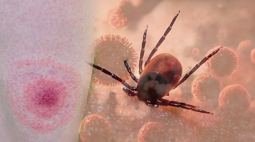 Kenelerden gelen tehlike: Lyme hastalığına yol açıyor: Bu belirtilere dikkat! Uzmanlar uyarıyor: "Lyme hastalığı ölümcül seyredebilir"