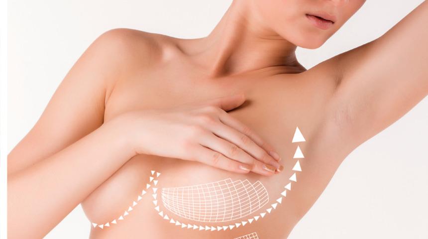 2017'de göğüs estetiği trendleri