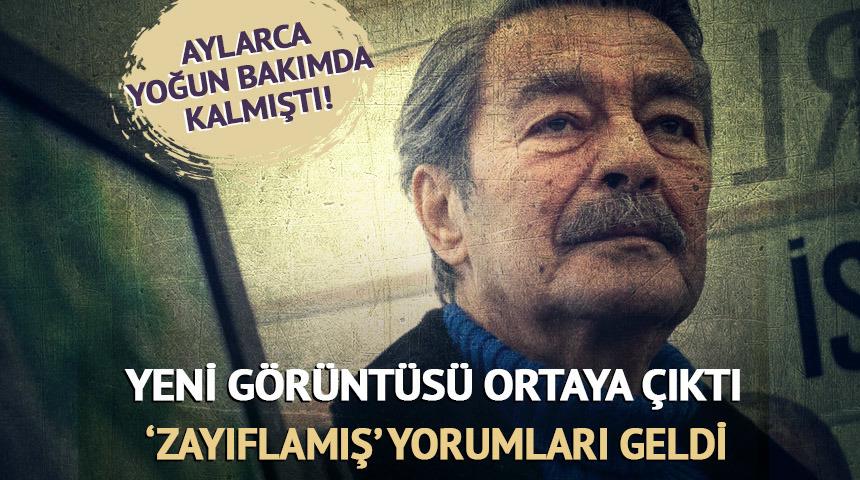 Aylarca yoğun bakımda kalmıştı! Son hali ortaya çıktı! 'Zayıflamış' 