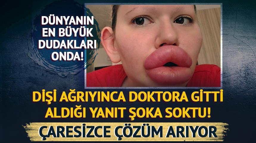 Dişi ağrıyınca doktora gitti, aldığı yanıt şoka soktu! Çaresizce çözüm arıyor