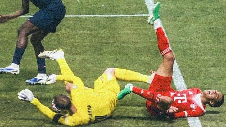 FIFA Kulüpler Dünya Kupası'nda kahreden sakatlık! Bayern Münih'in yıldız oyuncusu Jamal Musiala'nın bileği kırıldı... G2