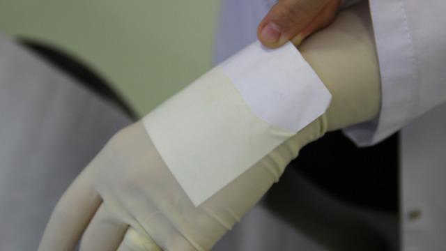 Bu eldiven, dünyada sağlık alanında bir ilk! Türk bilim insanları geliştirdi: “Sayım eldiveni” büyük kolaylık sağlayacak