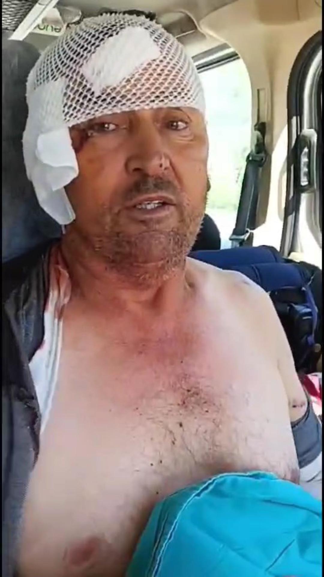 Aslan saldırısına uğrayan şahıs konuştu! O anları anlattı: Boynumdan ısırırken boynunu elime geçirdim 7