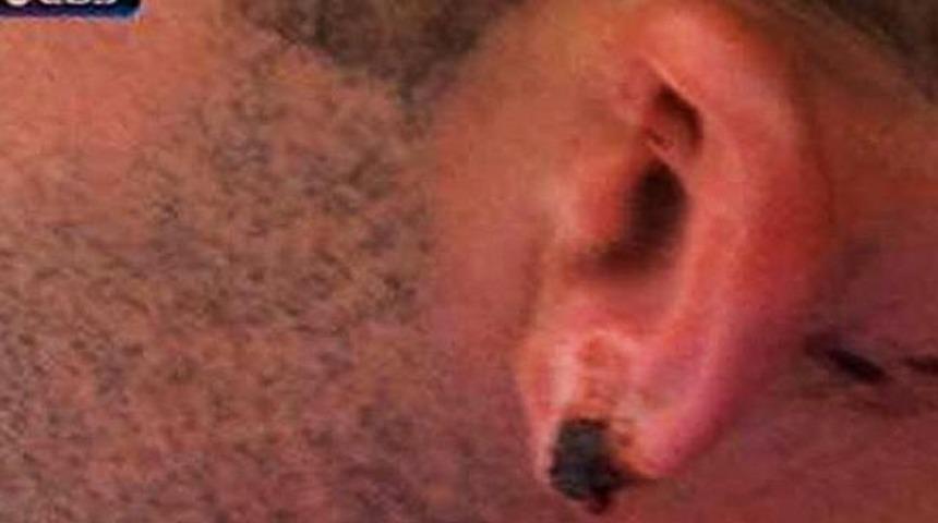 Kulak kopartan darbe..!