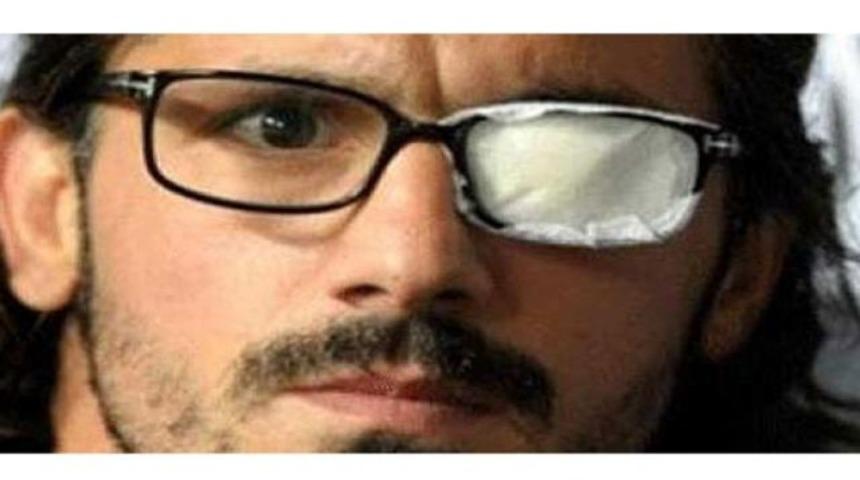 Gattuso k&ouml;r oldu!