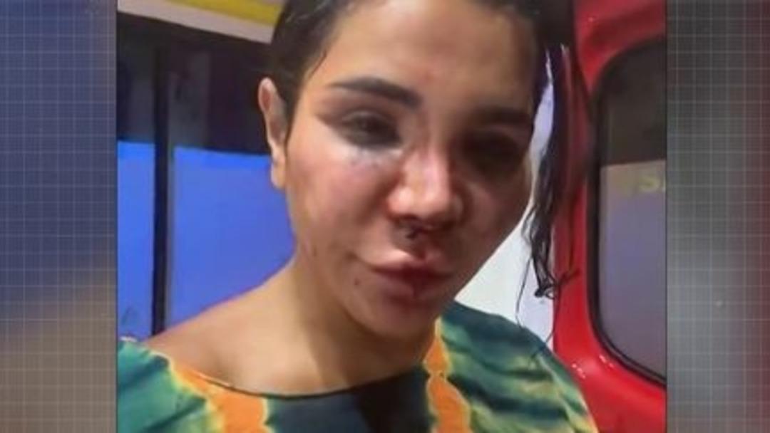 Sosyal medya fenomenine kabusu yaşattılar! Evine girip dövdüler, tecavüz edip çamaşır suyu döktüler... 2