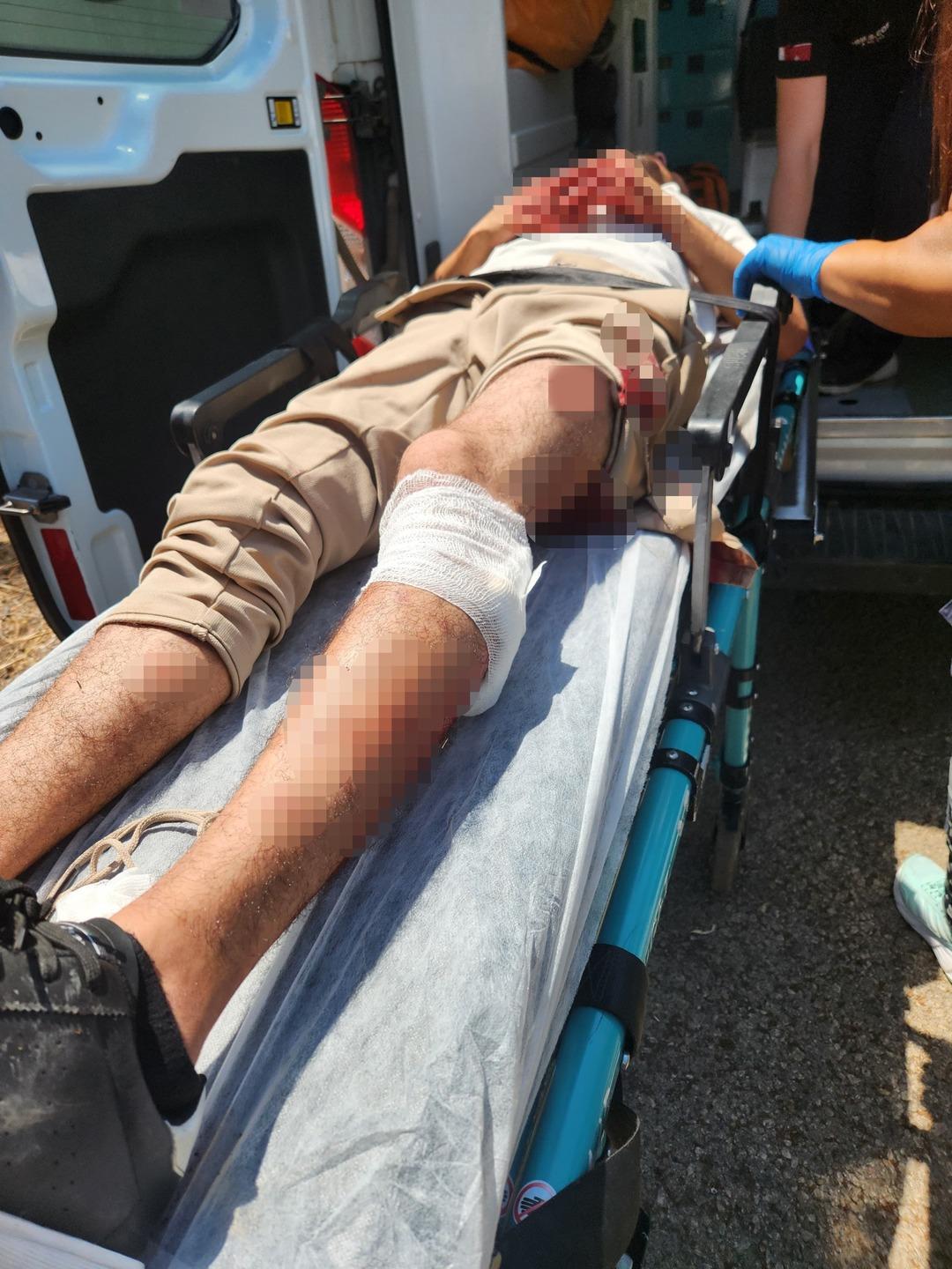 Tartıştığı kişiyi bacağından vurup başında bekledi! İfadesi pes dedirtti: "5 bin TL alacağım vardı" 2