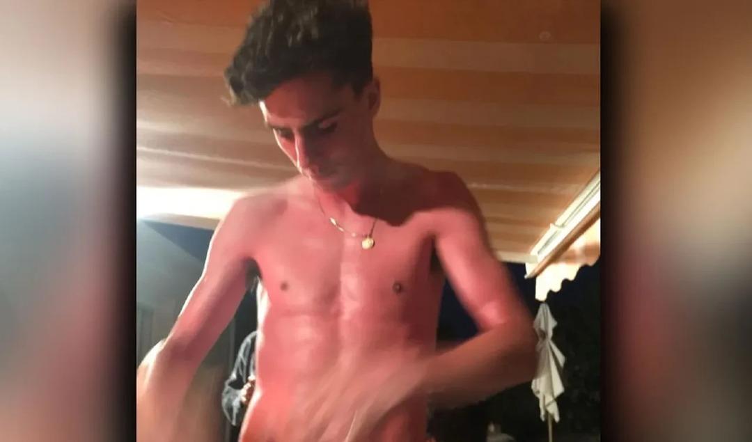 Altın kolye taktı, 5 gün yataktan kalkamadı! Uyandığında hayatının şokunu yaşadı! Derisi yüzülmüş... 2