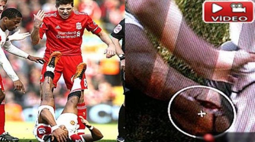 Carragher'dan Nani'ye inanılmaz faul! (Video)