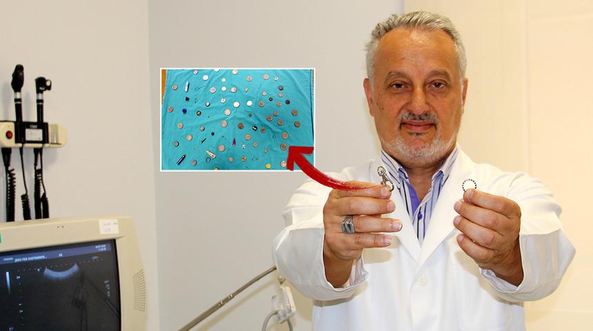 'Yanlışlıkla yutulanlar' koleksiyonunda yok yok! Oyuncak, çatal, toka...