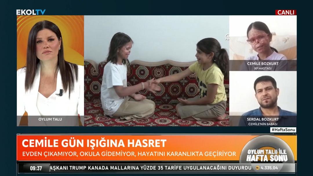 10 yaşındaki Cemile 8 yıldır güneşe hasret: Vücudu sünger gibi kendi kendini çekiyor! 1