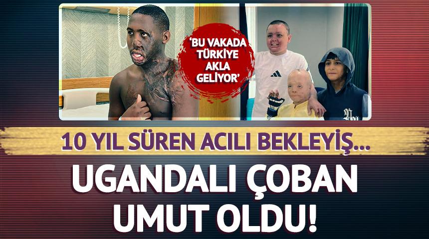 Yüzü ve boynunda ağır yanıklar vardı...