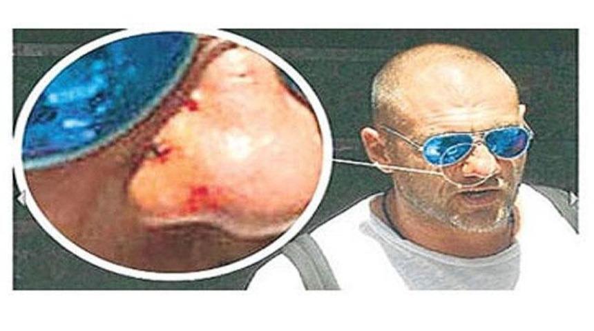 Vieri'nin burnu kopuyordu!