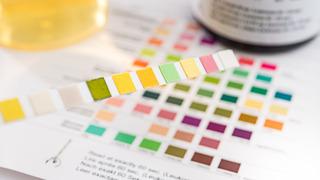 İdrarda kan görülmesi neyin habercisi olabilir?