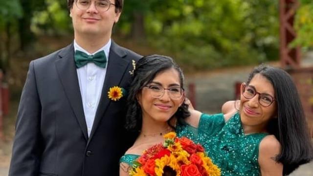 Kafa karıştıran olay! Yapışık ikizlerden biri evlendi diğer istemiyor! Üreme sistemleri ise...