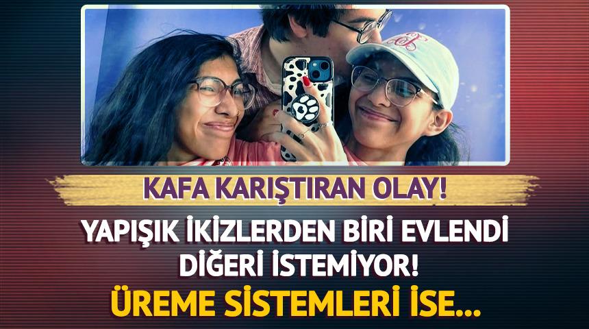 İlginç olay! Yapışık ikizlerden biri evlendi diğeri ise karşı çıktı! Üreme sistemleri ise...