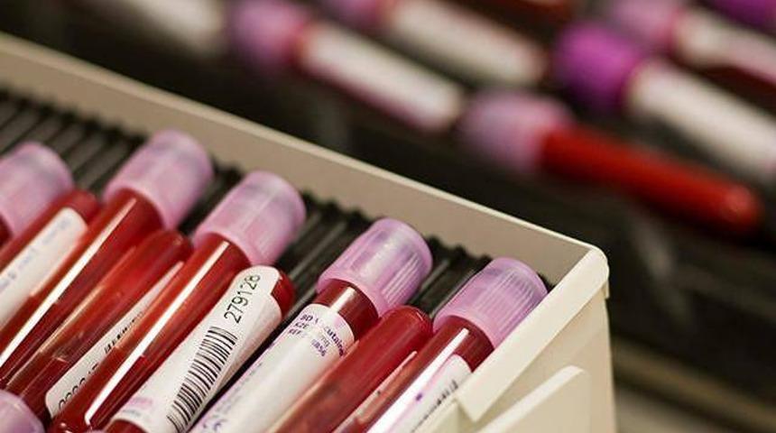 Doping volkanında T&uuml;rkiye zirvede