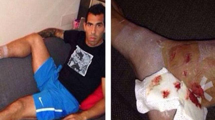 Tevez bu hale geldi!