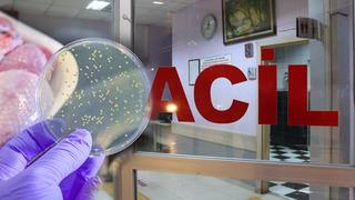 Aynı aileden 4 kişi hastaneye kaldırıldı! Uzmanlar 'gıda zehirlenmesine' karşı uyardı: Ölümcül seyredebiliyor