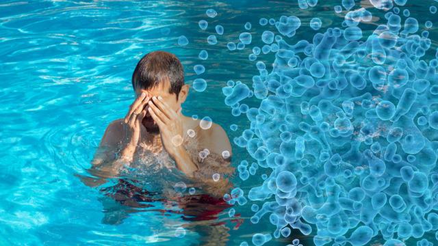 Bu enfeksiyonda ciddi artış var! Havuz ve denize girmeden önce dikkat: Ciltteki en küçük çizikten bile girebilir! 