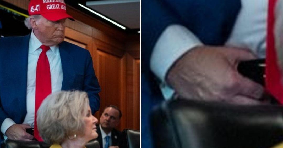 Donald Trump ın elindeki iz olay oldu! Yama yapmış gibi... 3