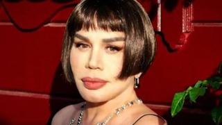 Saçlarını kazıttığı söylenmişti! Sezen Aksu'nun son hali ortaya çıktı