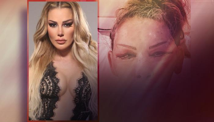 Petek Dinçöz'ün Annesi Göz Kamaştırıyor! Yüz Gençleştirme Ameliyatının Ardından Esra Süay Toğuş'un Yeni Hali Ortaya Çıktı
